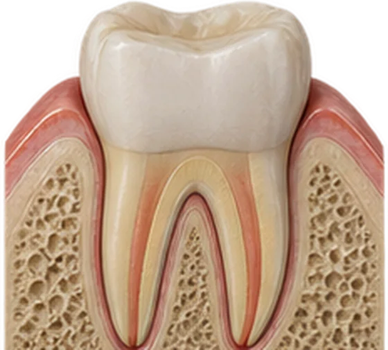 Dente restaurado