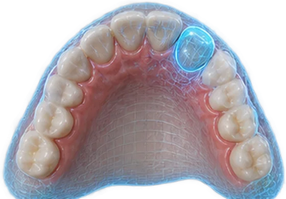 Arcada dentária vista de cima como modelo digital, com um dente em destaque